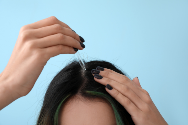 hair oils, hair loss remedies 